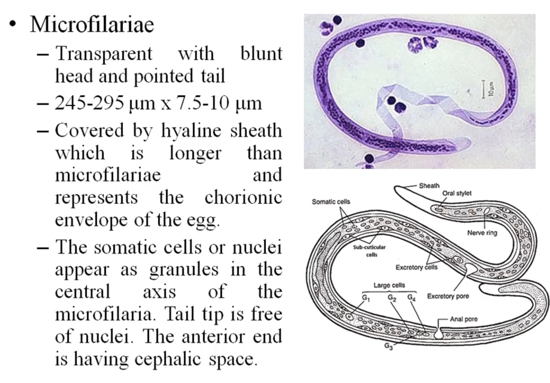 <p>Wuchereria bancrofti microfilaria </p>