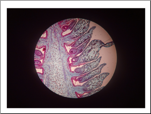Be able to identify the microsporangium, cone axis, and pollen grains
