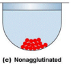<p>Not enough antibodies present in the test which cause the Antigens in the test to roll from the sides of the well to the center and form a mound at the bottom. </p>