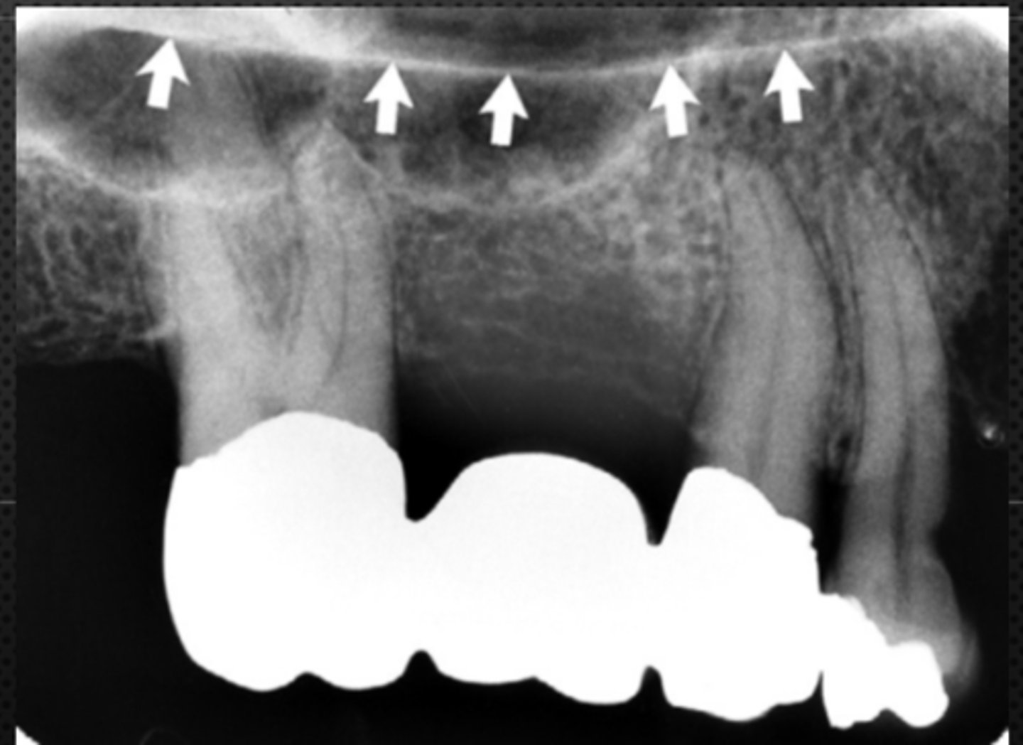 <p>Identify the structure</p>