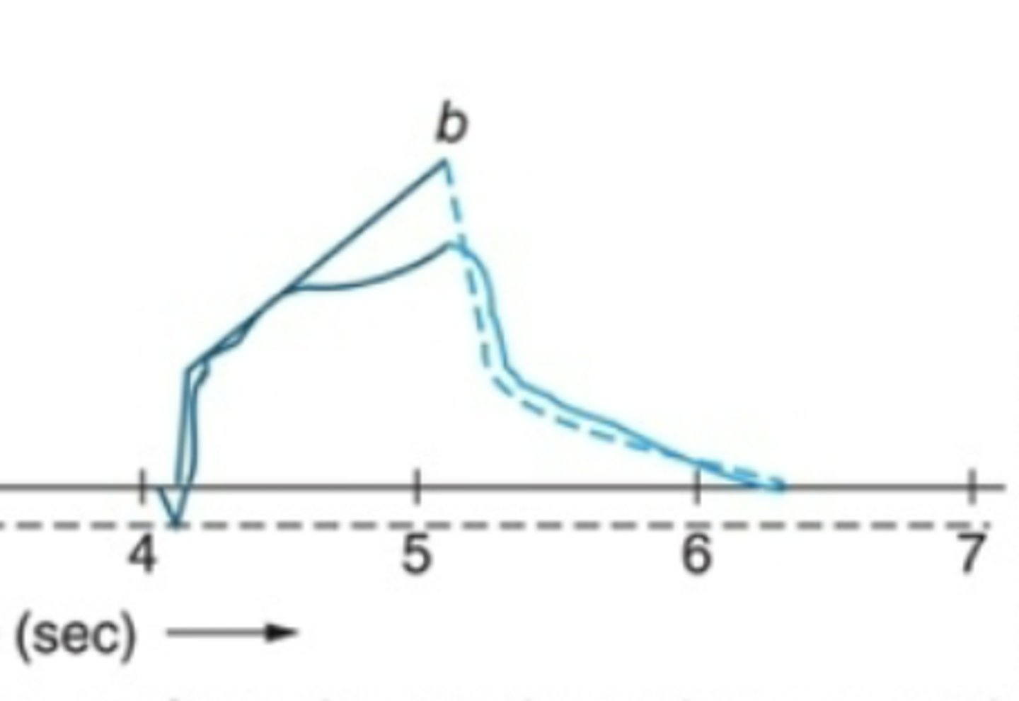 <p>Inadequate VT to meet demand</p><p>(Pressure time scale)</p>