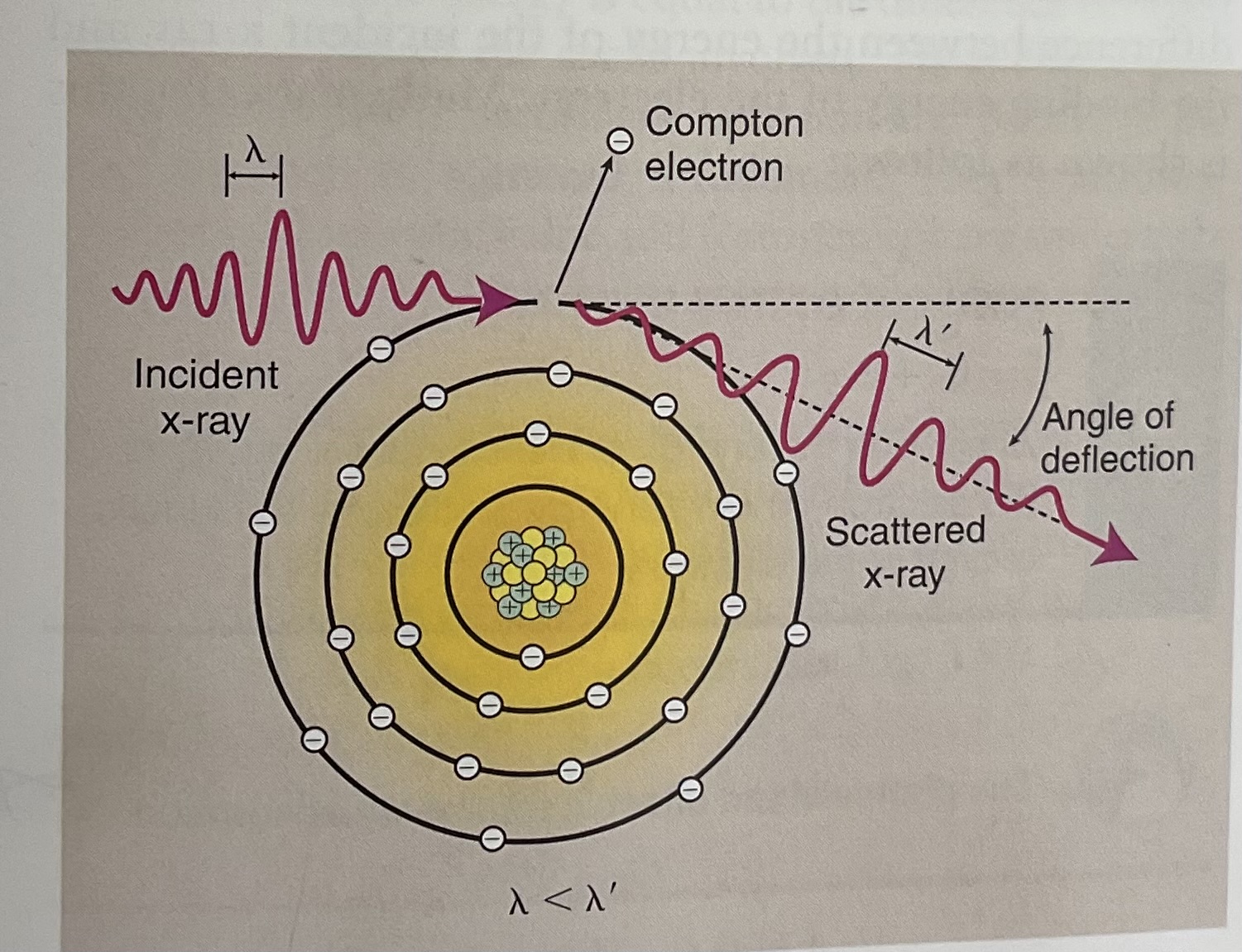 <p><span style="color: rgb(0, 0, 0)">Occurs throughout the diagnostic imaging range</span></p><p><span style="color: rgb(0, 0, 0)"><strong>A fairly high energy (high kVp) x-ray photon ejects an outer shell electron. The incident x-ray interacts with the outer electron shell on an atom of matter, removing it. (Ejecting it) called COMPTON ELECTRON</strong></span></p><p><span style="color: rgb(204, 204, 153)">-</span><span style="color: rgb(0, 0, 0)">It not only causes ionizes it but scatters the incident x-ray causing a reductions in energy and the change of direction.</span></p>