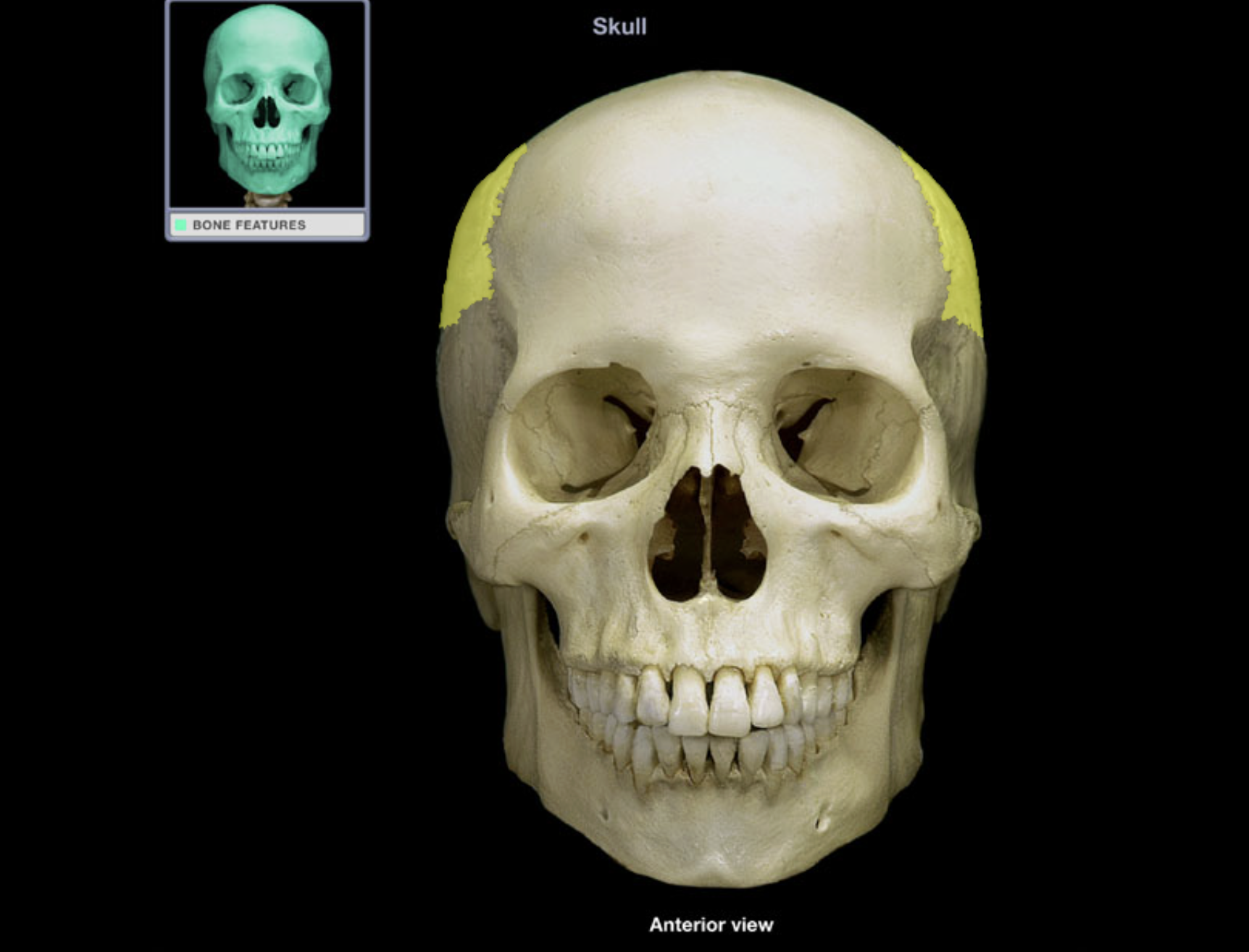 <p>Parietal bone</p>