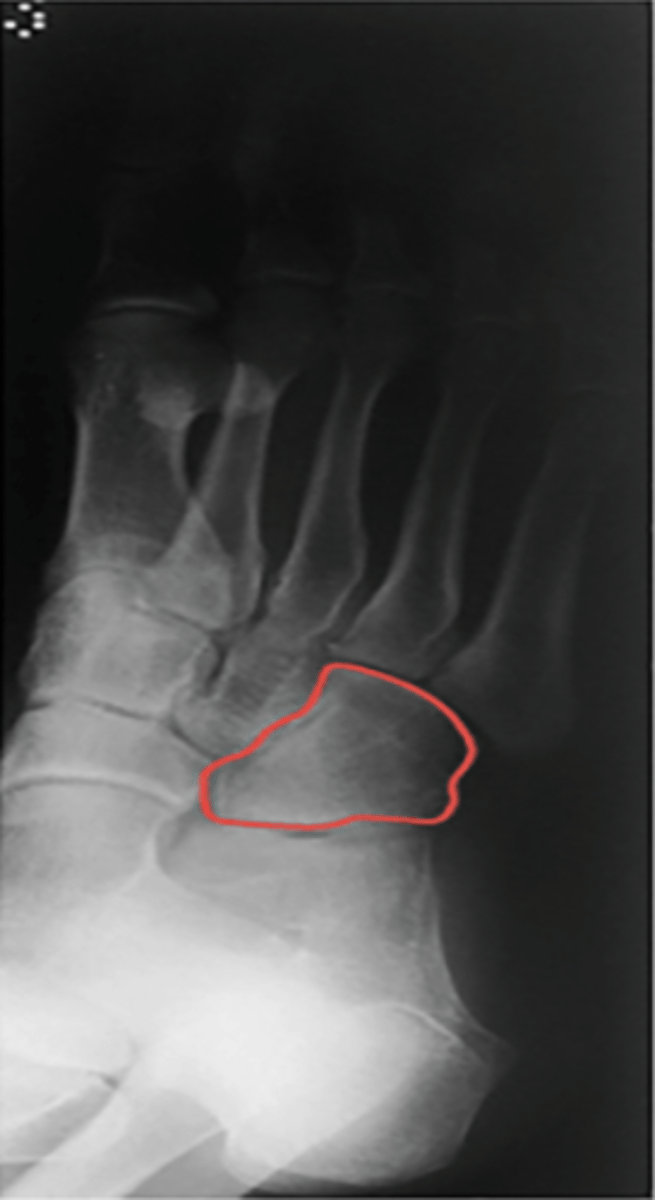 <p>What structure is highlighted?</p>