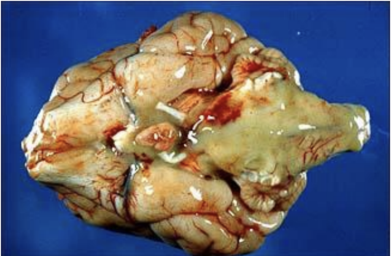 <p>exudate</p>