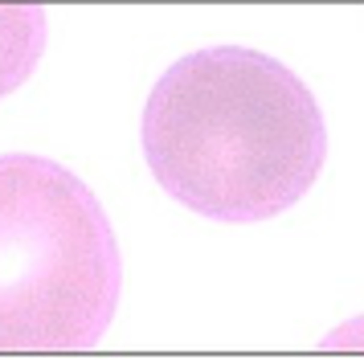 <p>What RBC morphology is this?</p>