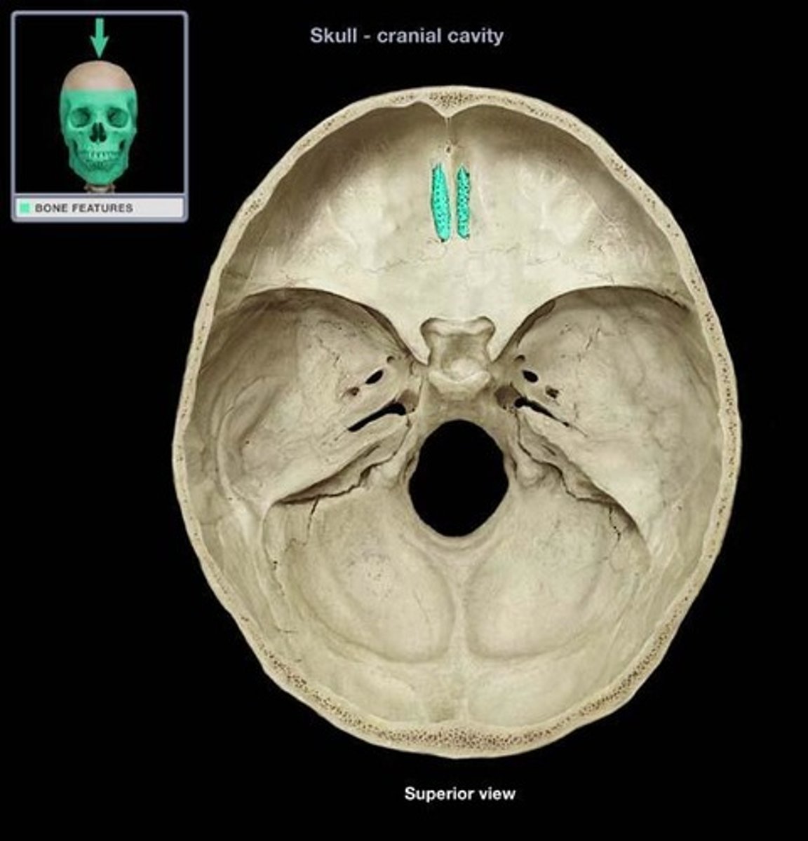 <p>Cribiform plate of ethmoid</p>