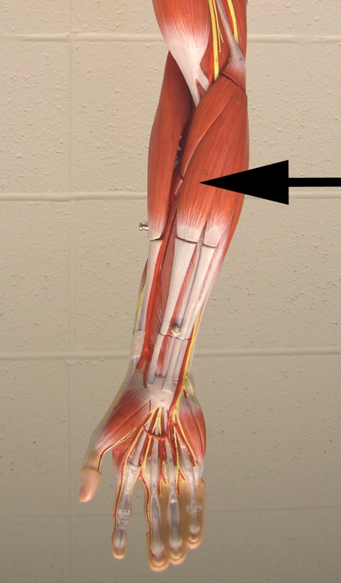 <p>What is one action of the muscle indicated by the arrow? </p><p>View: anterior side of the antebrachial </p>