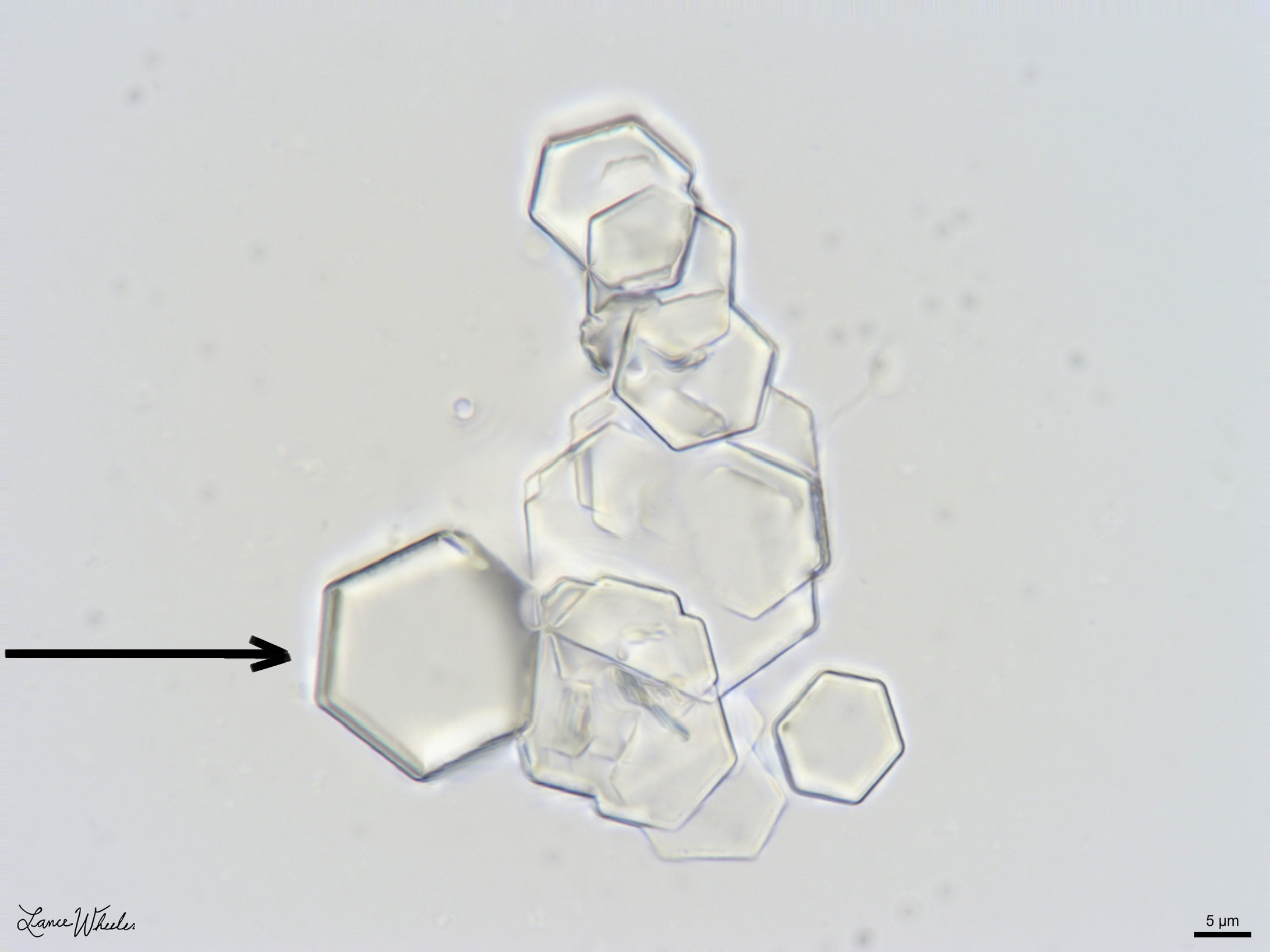 <ol><li><p>Identify pointed structure.</p></li><li><p>What test confirms the presence of this crystal?</p></li></ol><p></p>