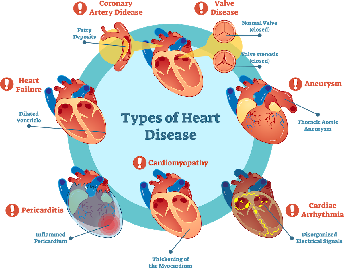 <p></p><ul><li><p>Includes coronary artery disease, arrythmia, cardiac arrest, hypertension, cardiac arrest, congestive heart failure</p></li><li><p>Symptoms include some mix of chest pain, shortness of breath, coughing or wheezing, swelling in extremities, fatigue, irregular or fast heartbeat</p></li></ul>