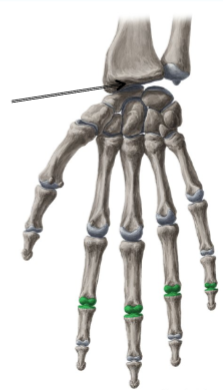 <p>Name joint</p>