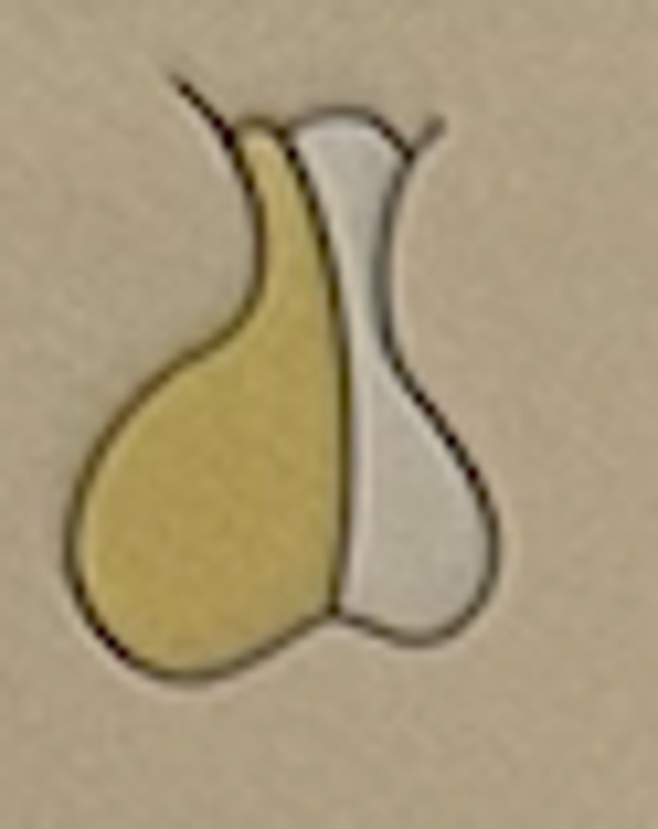 <p>Anterior pituitary (adenohypophysis)</p>