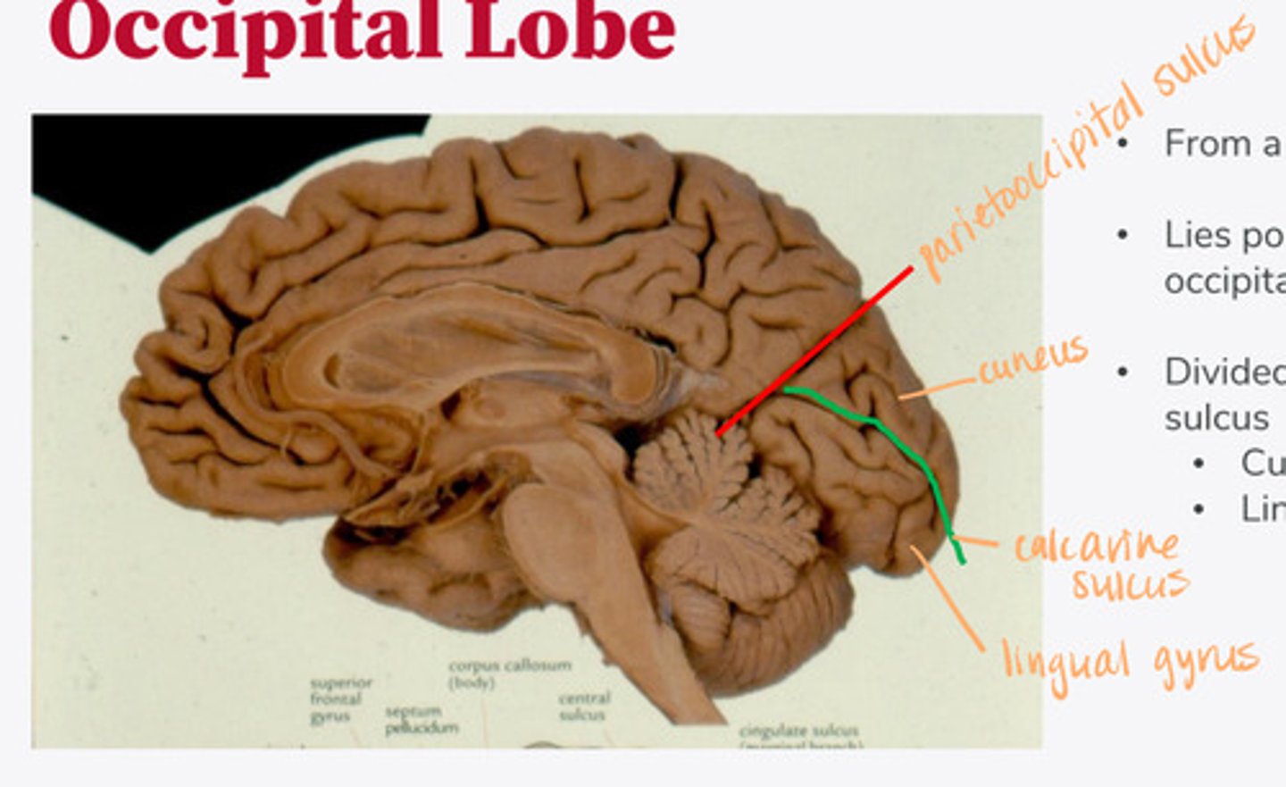 <p>Where is the occipital lobe located in a medial/mid-saggital view of the brain?</p>