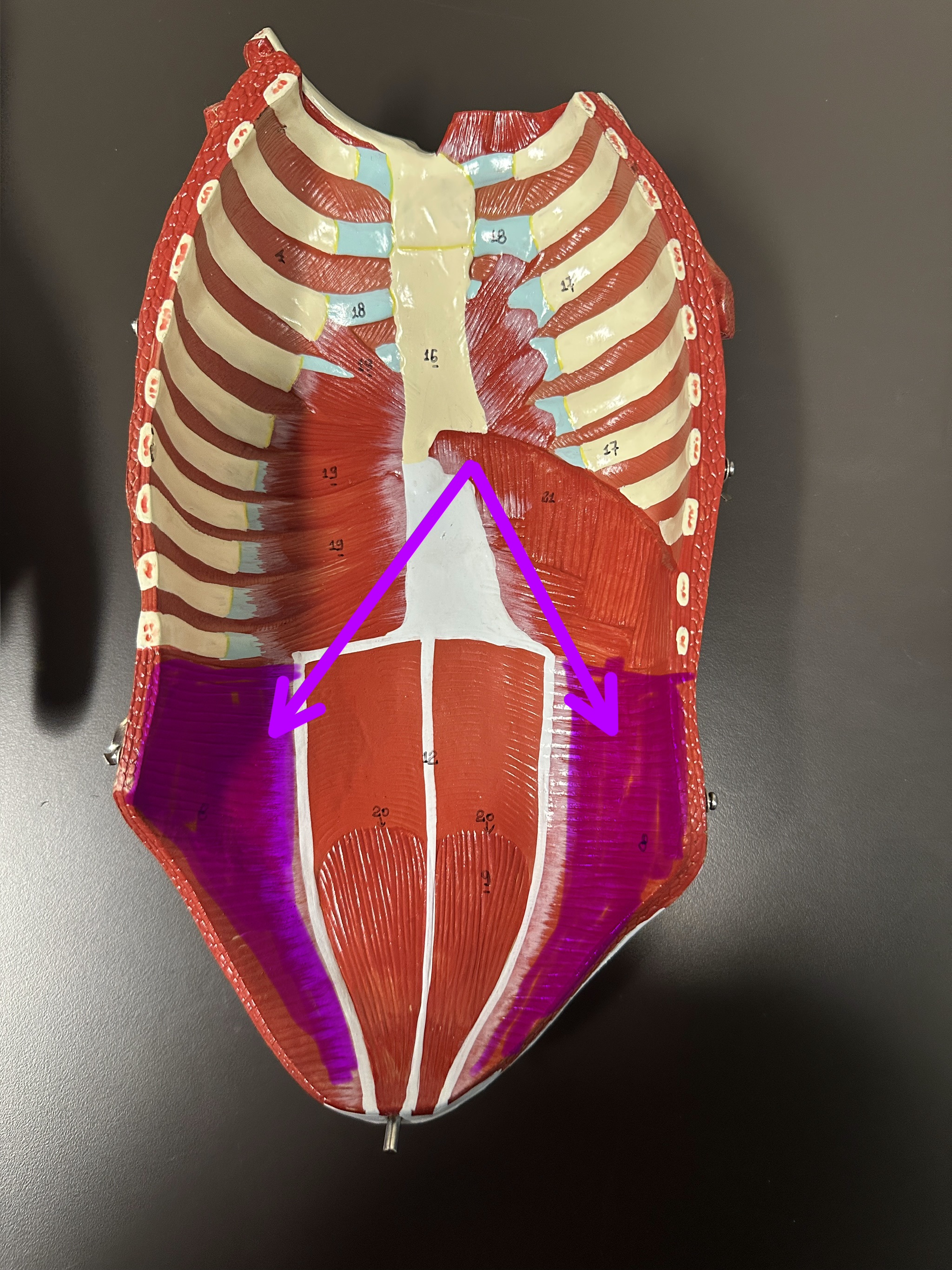<p>What is the highlighted structure</p>