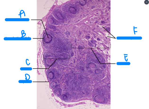 <p>B</p>
