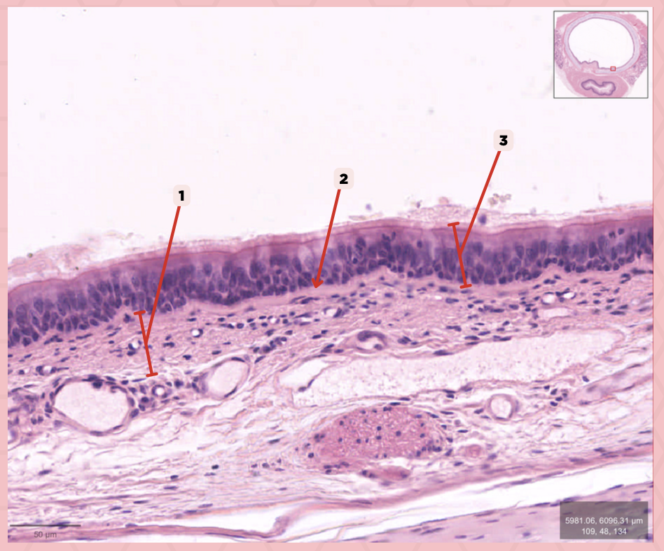 <p>Identify the structure labeled as 3.</p>