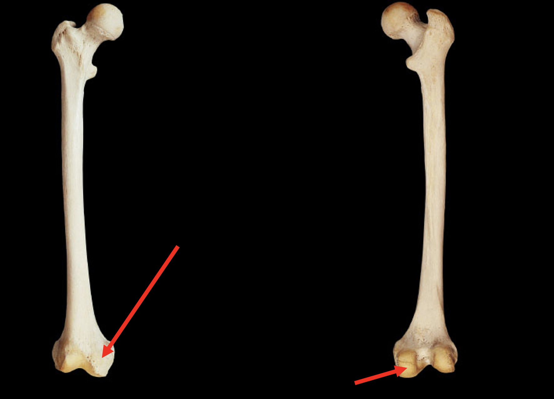 <p>Name this region of the femur</p>