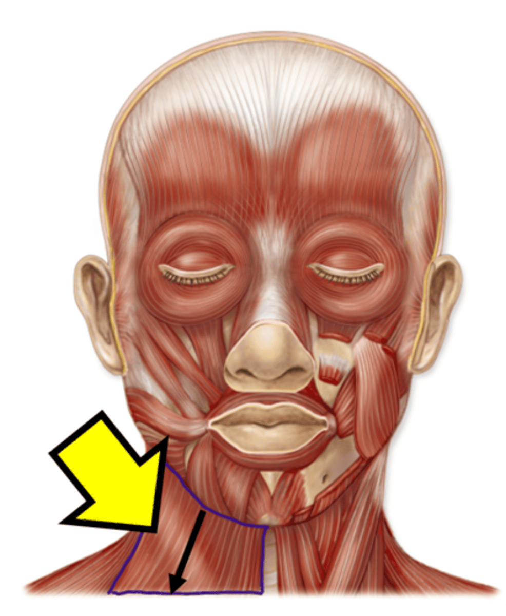 <p>Name the muscle.</p>