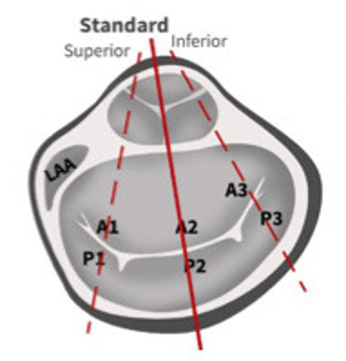 <p>What view is represented by the line</p>