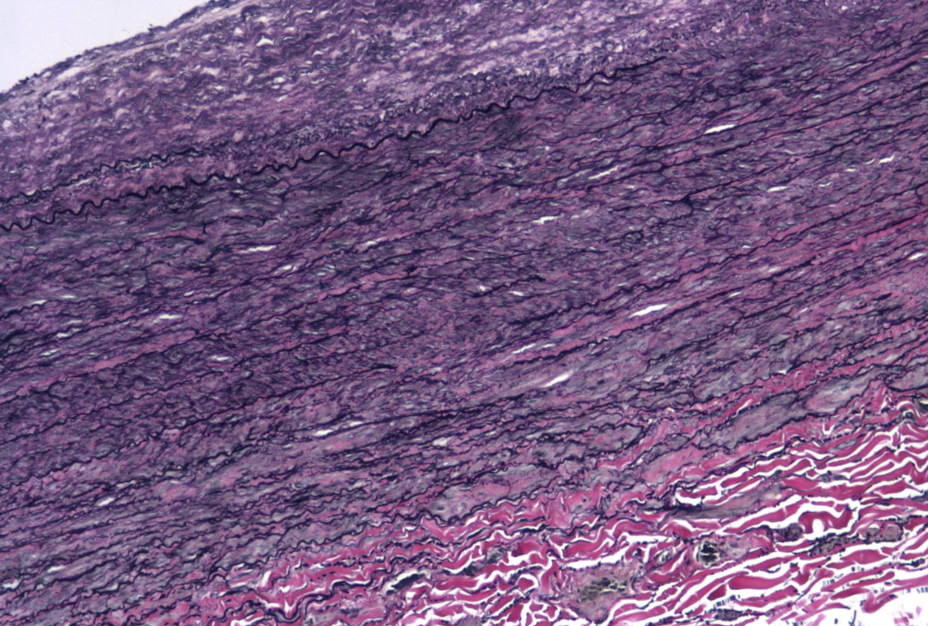 <p>ID the stain type </p>