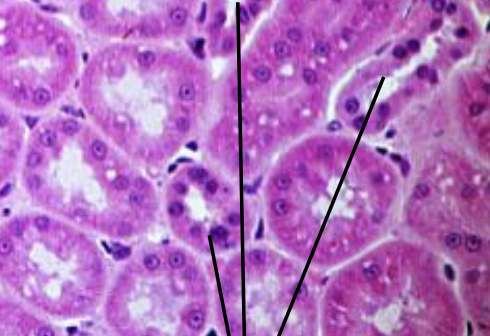 <p>what is the histology showing?</p>