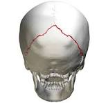 <p>sagittal suture</p>
