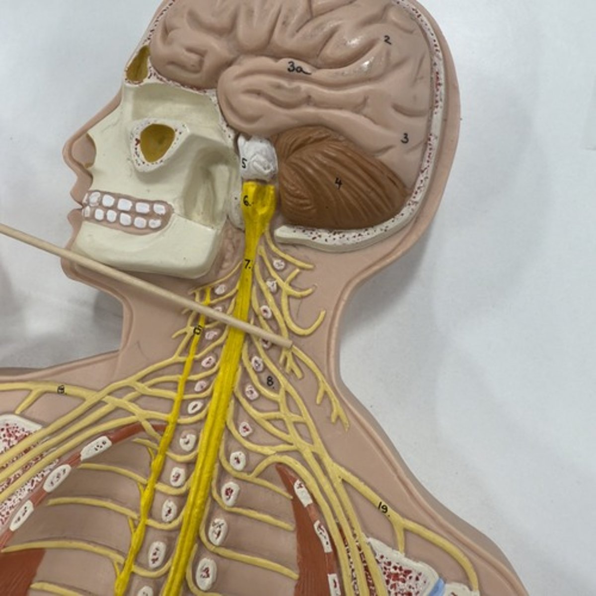 <p>Identify the nerve.</p>