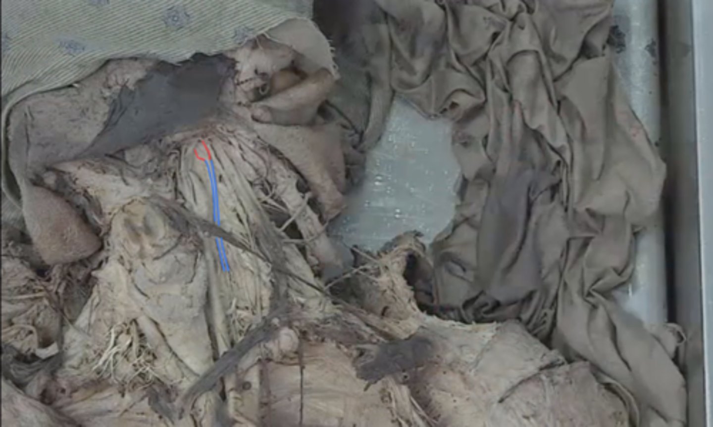 <p>identify this structure in red (very top of sympathetic trunk)</p>