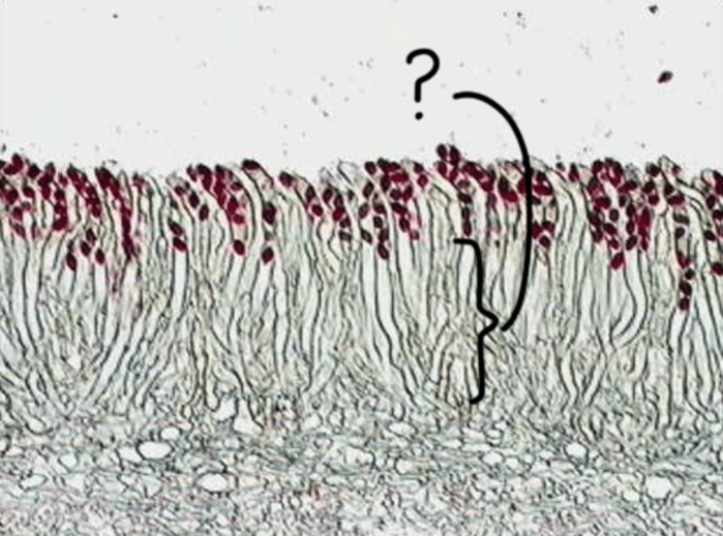 <p>A stalk-like structure that supports the cap or fruiting body of some fungi, such as mushrooms, often extending from the substrate or the center of the ascocarp.</p>