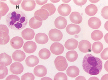 <p>Other than the cells labeled N and E, what other types of cells are shown in the picture and what type of nucleus do they have?</p>