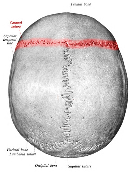 <p>Seperates the frontal from the two parietal bones</p>