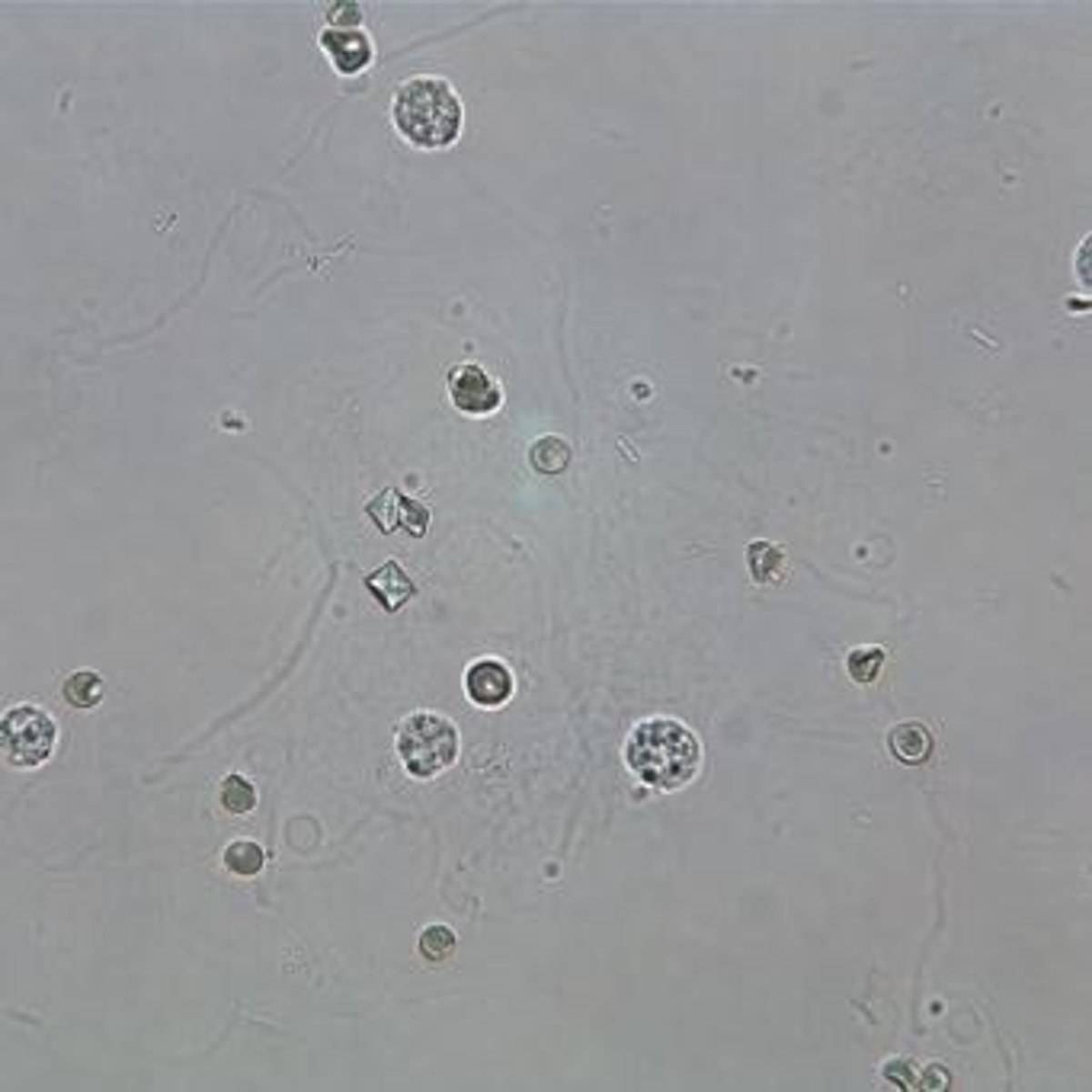 <p>Granular appearance, colorless to yellow-brown, observed under Brightfield at 40x.</p>