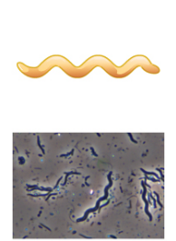 <p>What&apos;s the shape of this bacteria?</p>
