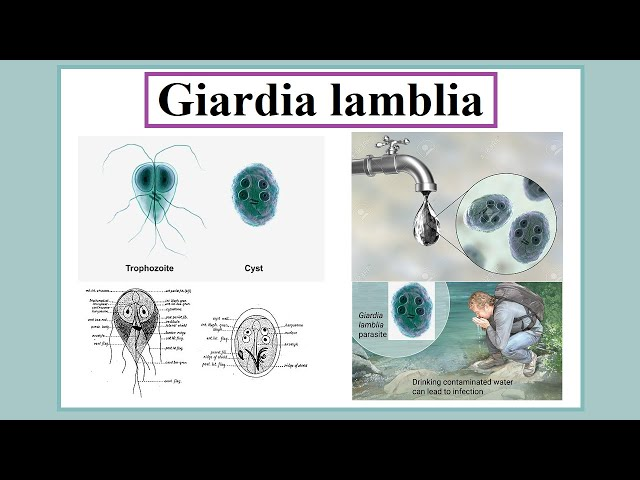 <p>So humans swallow the _____, which germinates into trophozoites in the ______ ______ (name organ).</p>