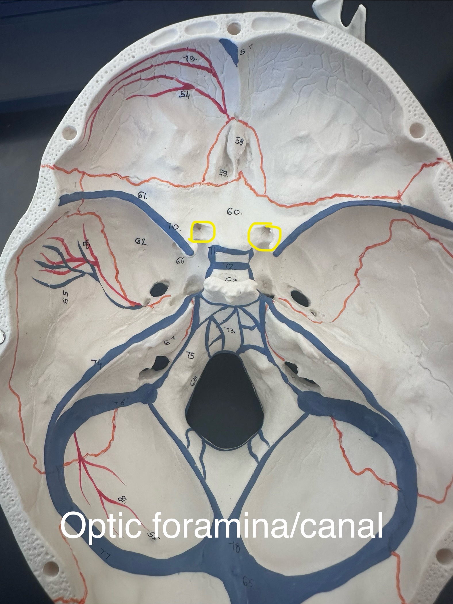 <p>Optic Foramina (canal)</p>