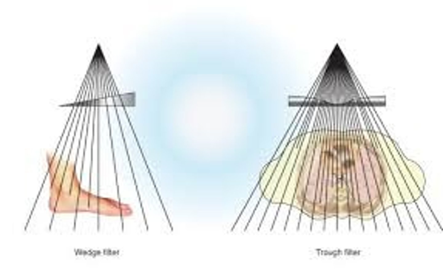 <p>used for nonuniform anatomy areas, evens out the exposure of each area</p>