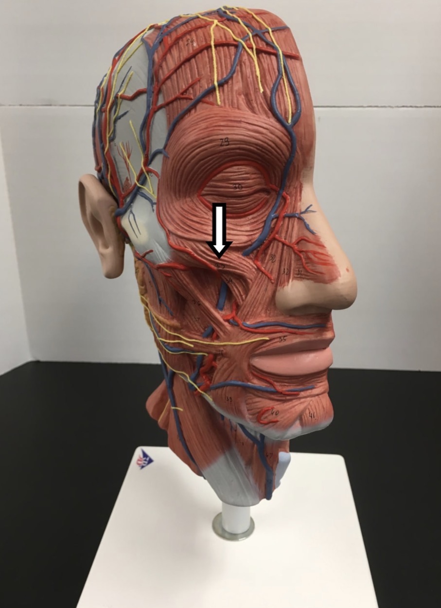 <p><span>Name the muscle labeled with the white arrow below:</span></p>