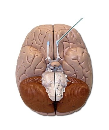 <p>Cranial nerve 1 *purely sensory *sense of smell</p>