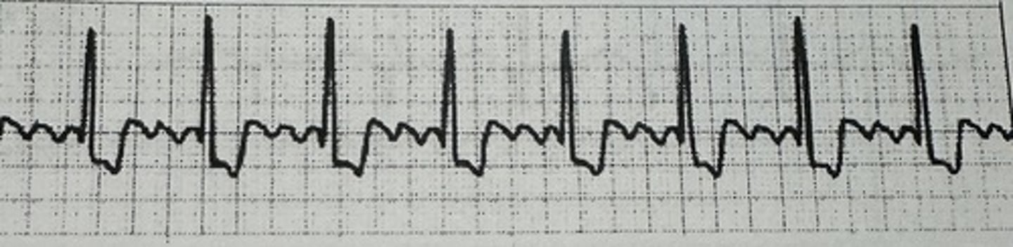 <p>identify the rhythm</p>