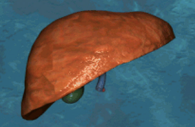 <p>Which surface of the liver is this? And describe it. </p>