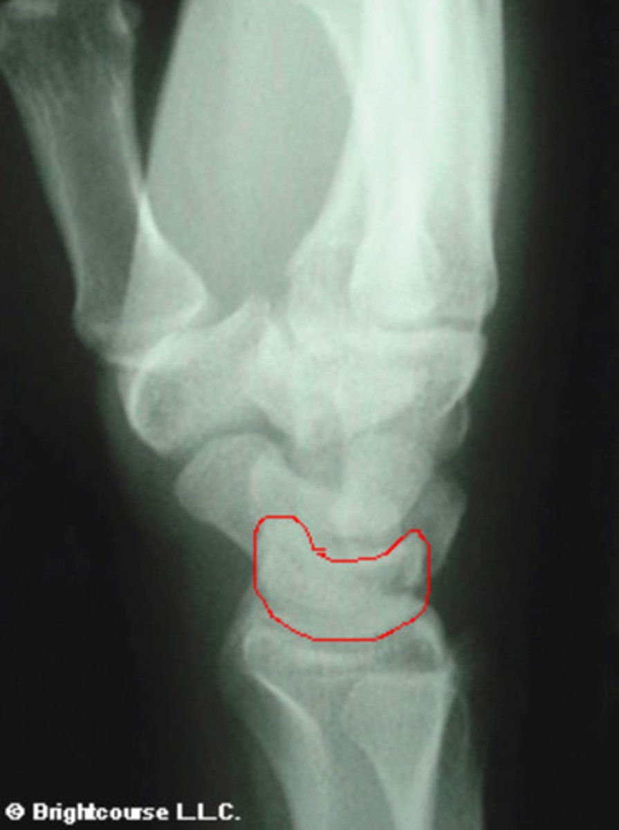 <p>What structure is being circled in this image?</p>