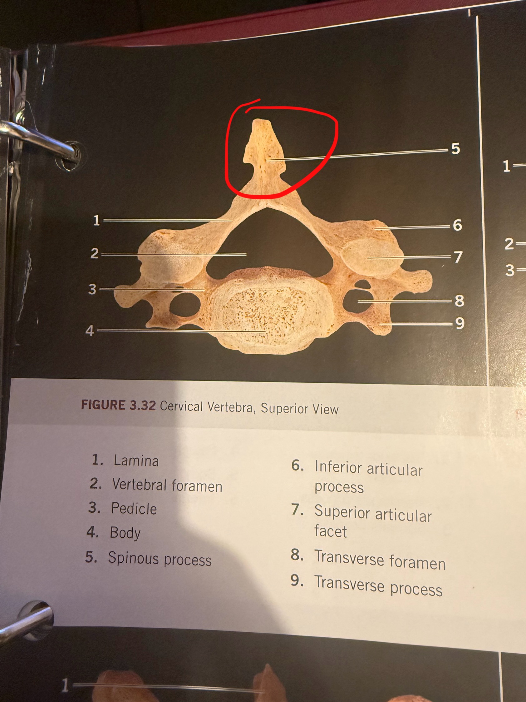 term image