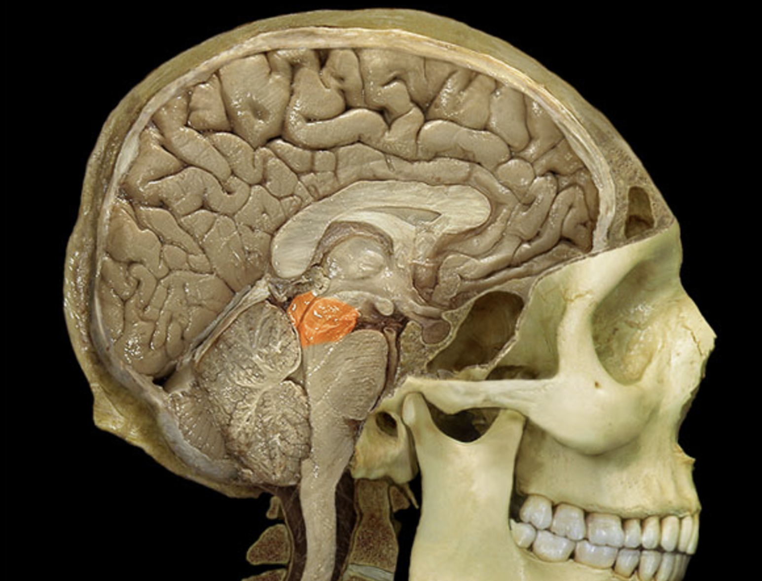 term image