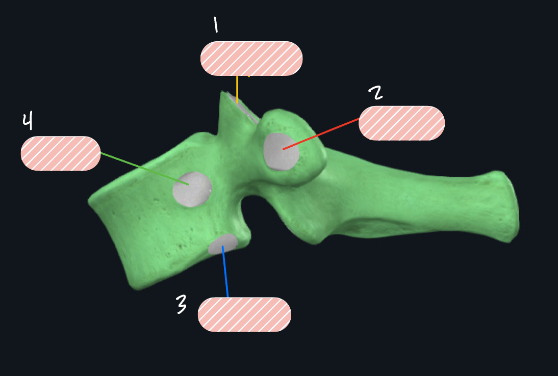 <p>What vertebra is this?</p>