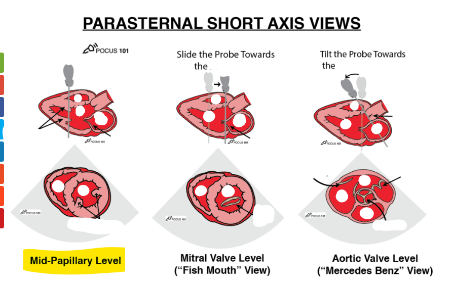 <p>label structures</p>