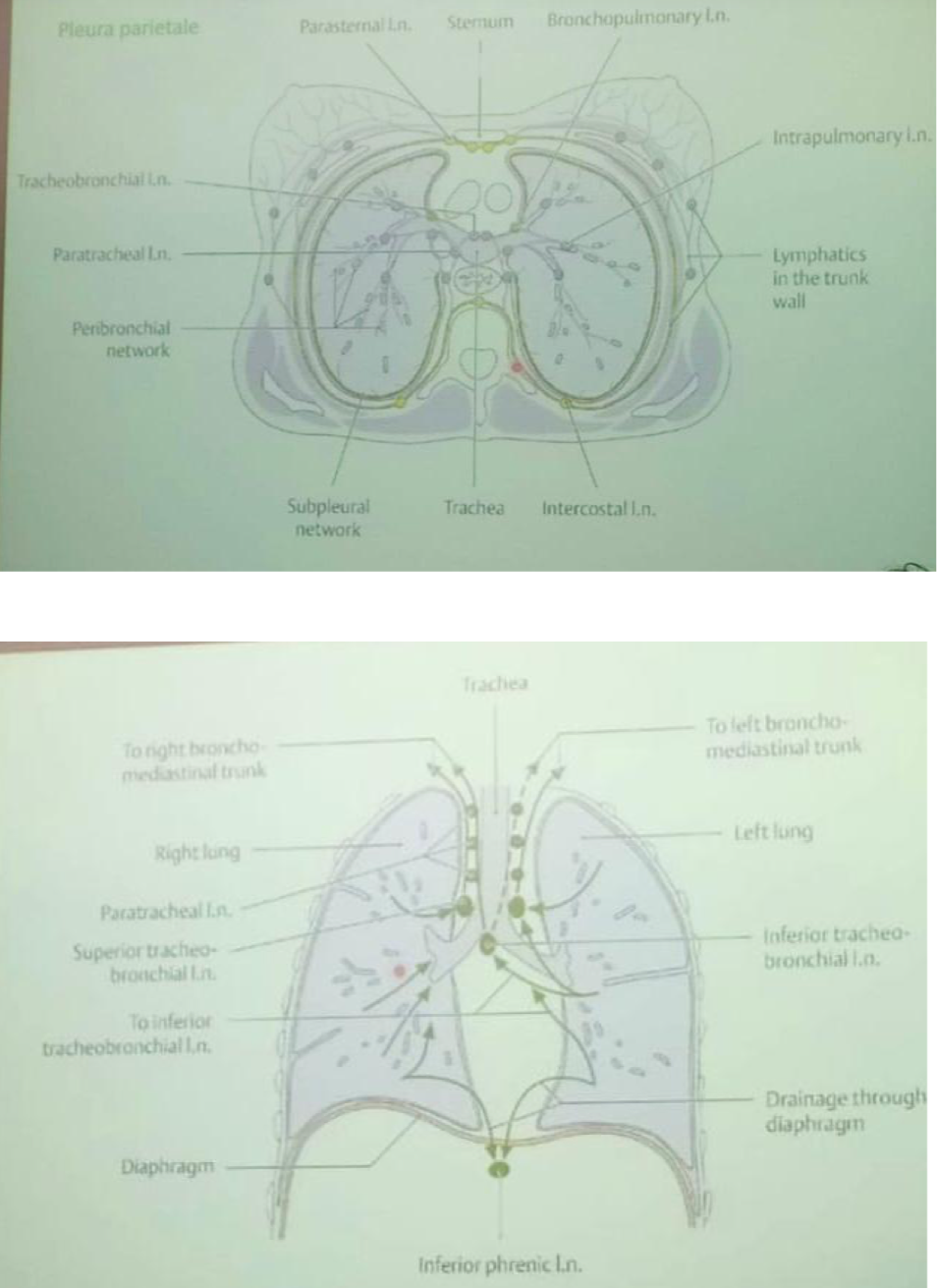 <p>I vasi linfatici raccolgono la linfa dal parenchima polmonare e albero bronchiale, per poi convogliarla in una serie di linfonodi in questo ordine:</p><ul><li><p>Linfonodi Intrapolmonari all’interno del polmone</p></li><li><p>Linfonodi Broncopolmonari a livello dell’ilo polmonare</p></li><li><p>Linfonodi Tracheobronchiali inferiori e superiori rispetto alla biforcazione bronchiale</p></li><li><p>Linfonodi Paratracheali a livello della trachea</p></li><li><p>Tronco Broncomediastinico destro e sinistro che sboccano:</p><ul><li><p>Direttamente nella vena brachiocefalica</p></li><li><p>Nel dotto toracico a sx o dotto linfatico destro a dx per poi aprirsi nell’angolo venoso</p></li></ul></li></ul><p>Generalmente la linfa del polmone dx drena nei linfonodi di dx e quella del polmone sx nei linfonodi di sx, MA:</p><ul><li><p>Il lobo inferiore sinistro può drenare nei linfonodi tracheobronchiali di entrambi i lati</p></li><li><p>Questo spiega perché un tumore del lobo inferiore sinistro può metastatizzare anche ai linfonodi del lato destro del mediastino</p></li></ul><p></p>