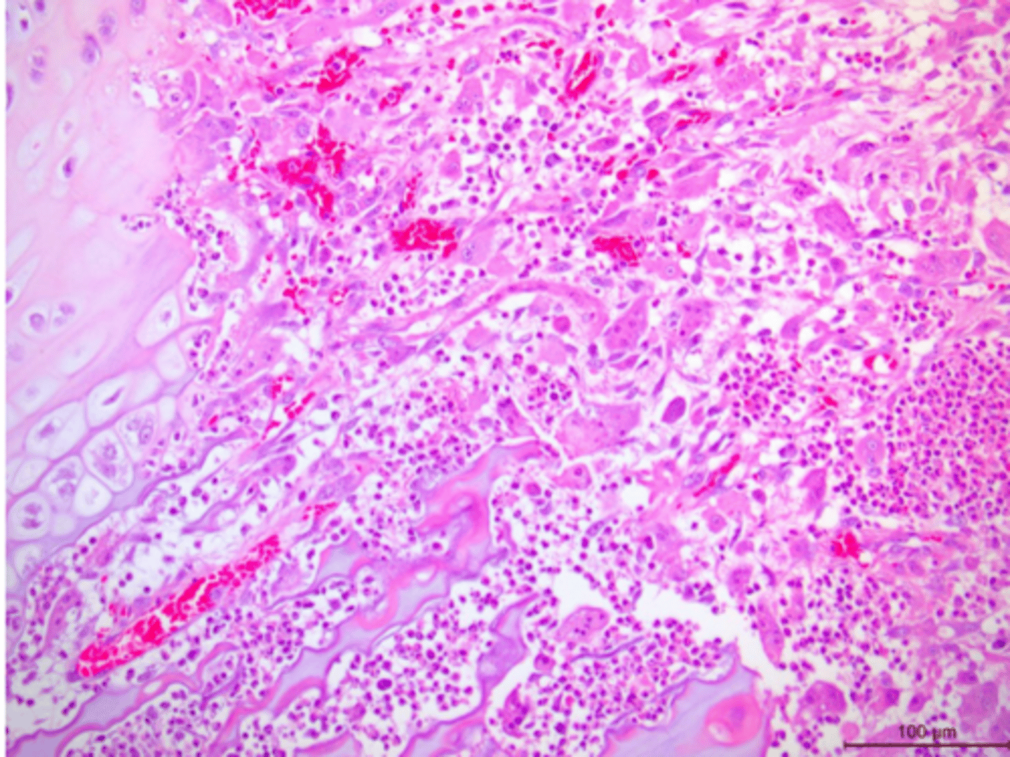 <p>Identify the pathology:</p>