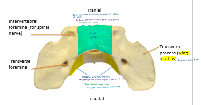 <p>No spinous process, Large transverse process</p><p>Reduced body</p><p>C1 </p><p>Articulate with occipital bone to form atlanto-occipital joint (move head up and down)</p>