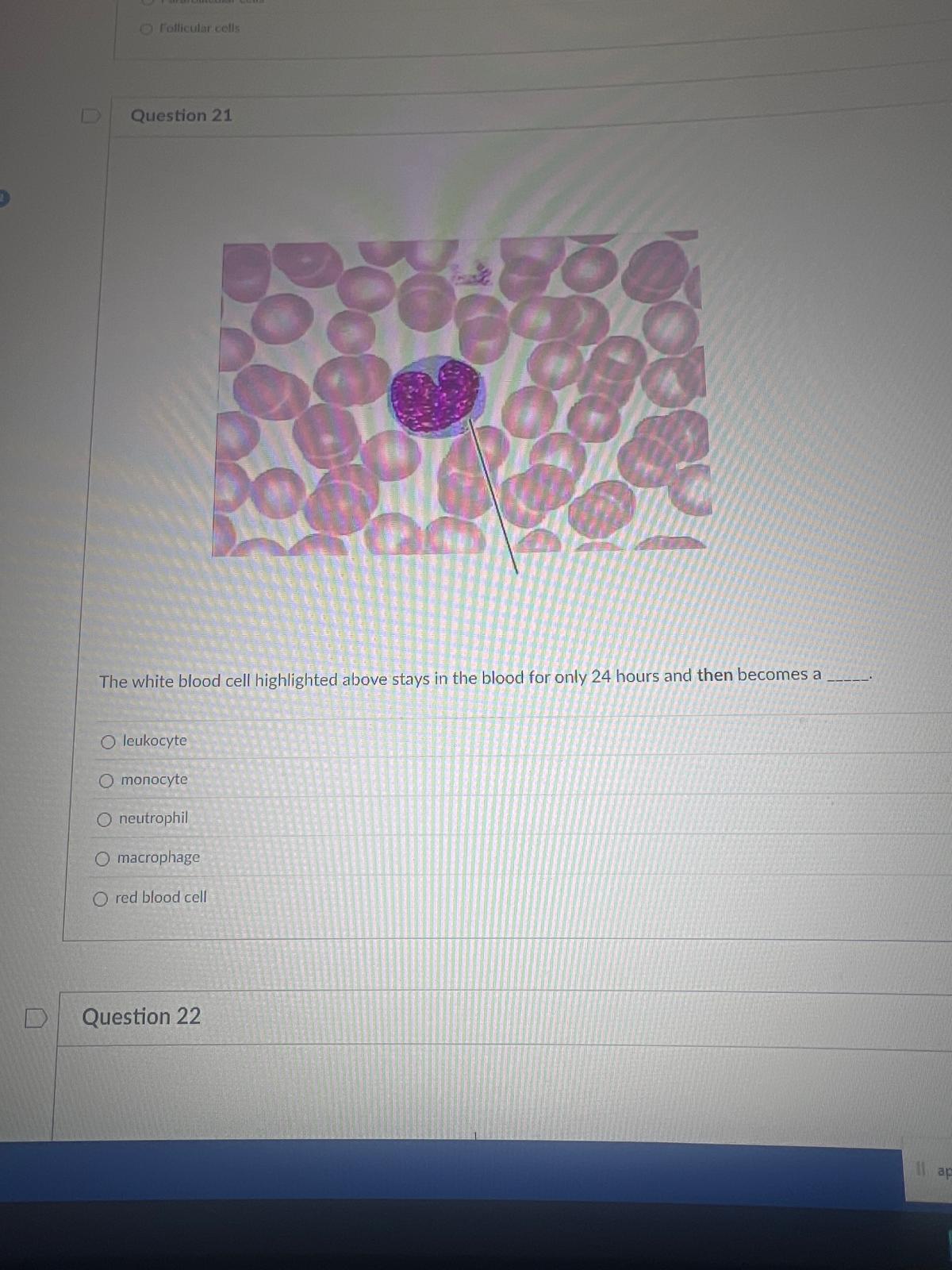 <p><span>The white blood cell highlighted above stays in the blood for only 24 hours and then becomes a BLANK.</span></p><p><span>leukocyte</span></p><p><span>monocyte</span></p><p><span>neutrophil</span></p><p><span>macrophage</span></p><p><span>red blood cell</span></p>