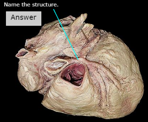<p>What artery is this</p>